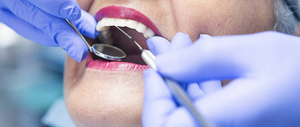Best Emergency Tooth Extraction in Cherry Valley, IL