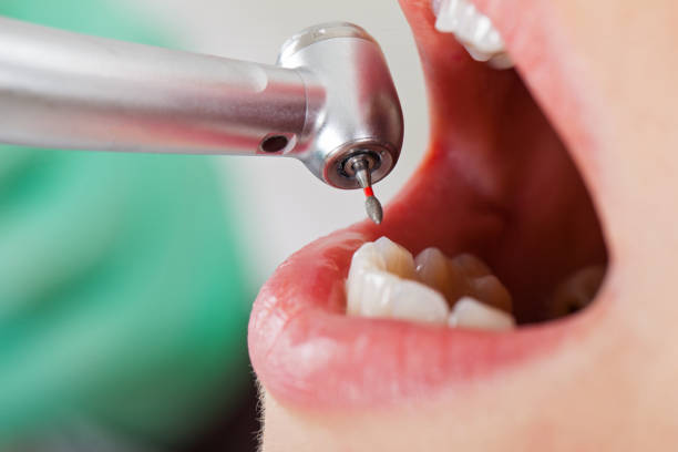 Best Cosmetic Emergency Dentistry in Cherry Valley, IL